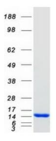 SDS-PAGE (S100A9-12HFL).jpg